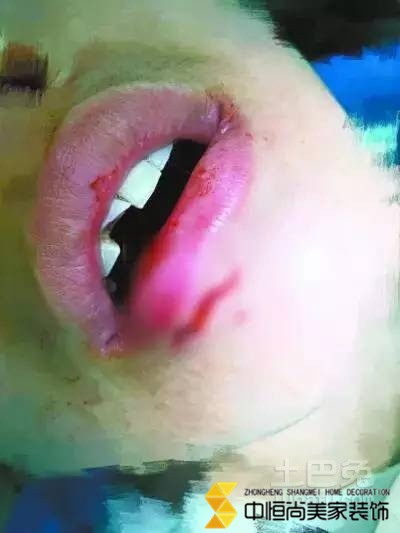 西安装饰公司,宜家水杯发生爆炸 宜家:将承担相应赔偿 西安装饰公司,宜家水杯发生爆炸 宜家:将承担相应赔偿